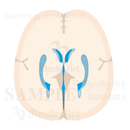 Horizental section of Cerebralventricle2(Judging from superior aspect)