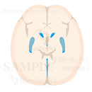 脳室の水平断3（上面）
