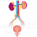 A illness in which stones or calculus from kidney to urinary, a condition called urinary calculi