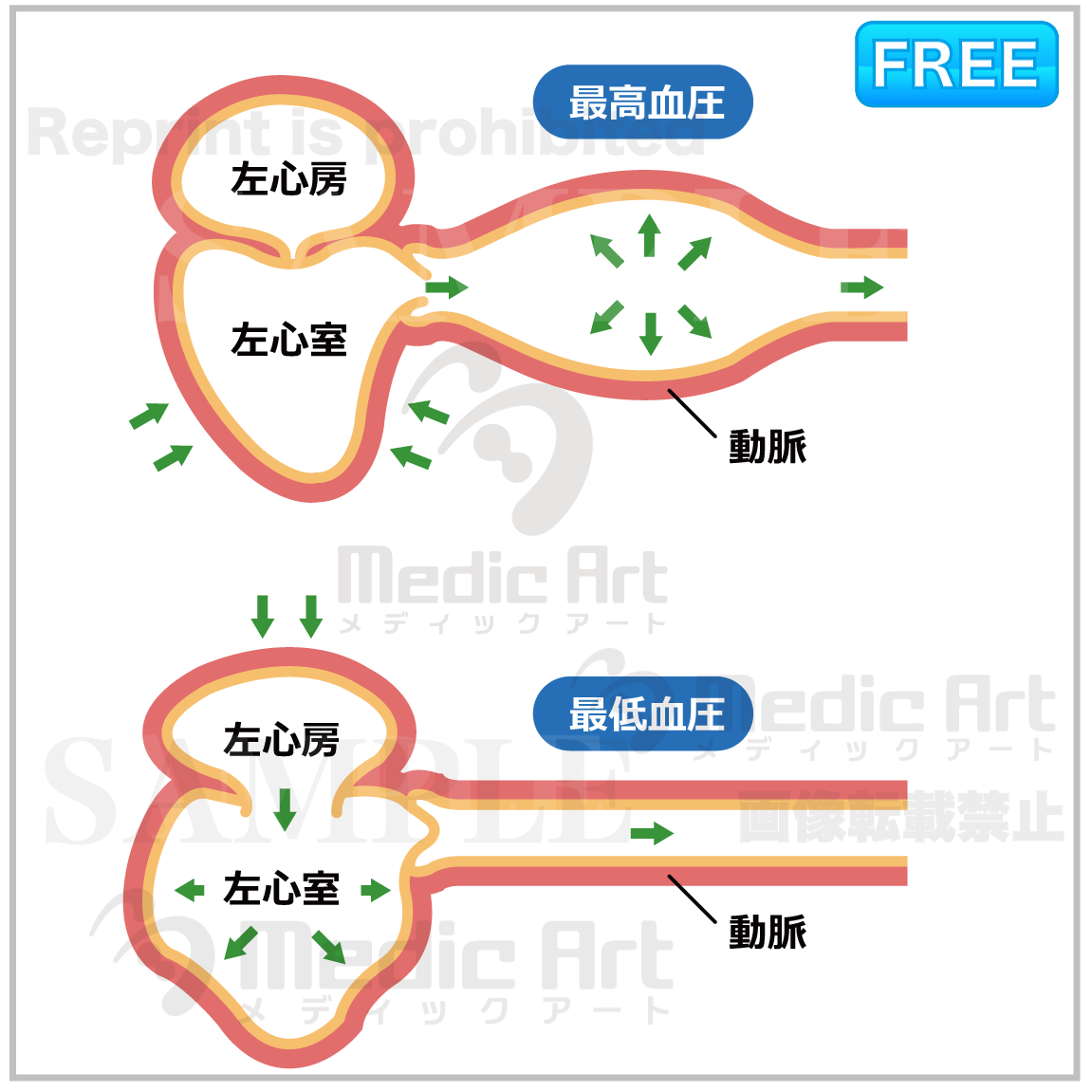 「最高血圧のときの心臓：収縮期血圧」と「最低血圧のときの心臓：拡張期血圧」［心臓全体の図、文字付)