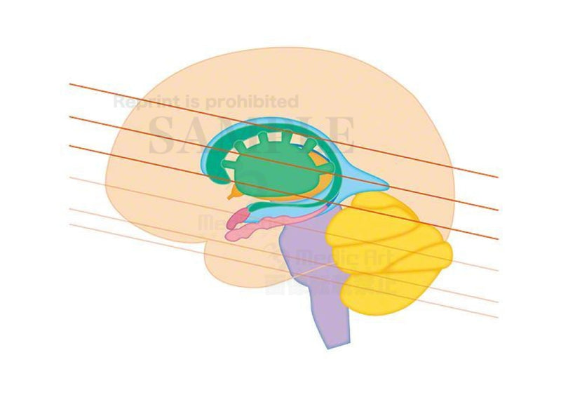 大脳基底核と間脳、小脳の断面（水平断）