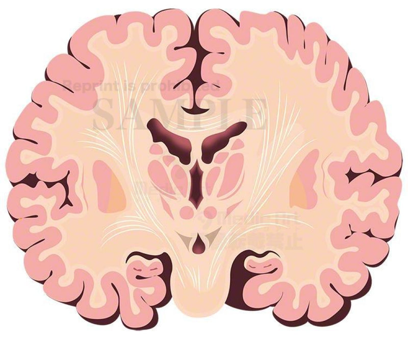 Brain (frontal cross