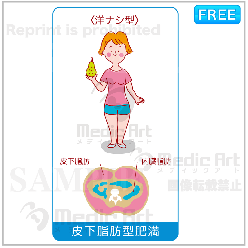 Subcutaneous fat obesity is pear type ［with Japanese letters］