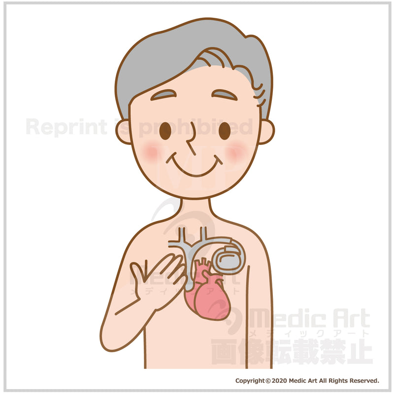 Patient wearing a pacemaker