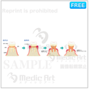 The progression of periodontal disease 【F：with letters