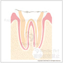 Progression of dental caries and treatmen 4b