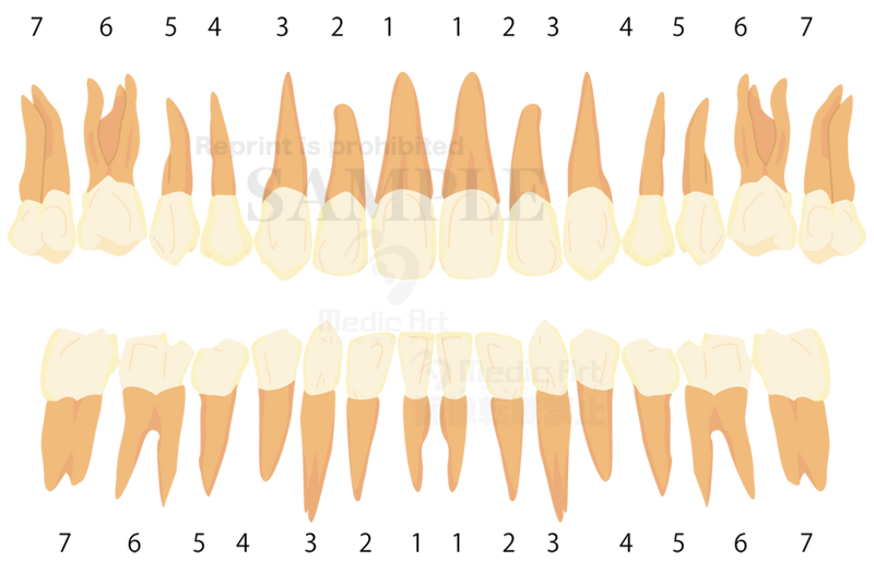 Dntition(Schematic view of adult teeth)