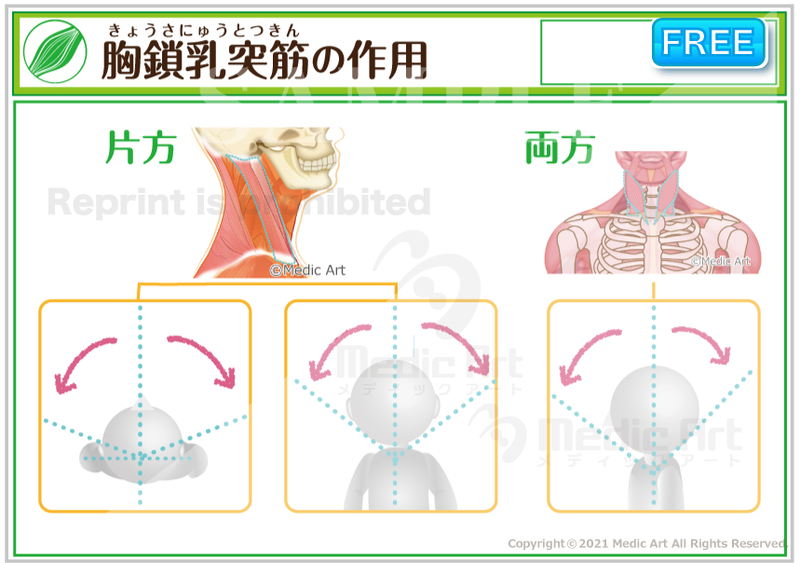 【首の周囲の筋肉】胸鎖乳突筋（きょうさにゅうとつきん）の作用 ［シート］