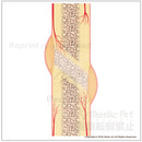 骨折が治るしくみ（3）