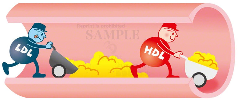 Ldl)Hdl)