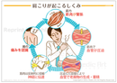 肩こりが起こるしくみ［シート］