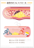 血管内のコレステロール ［シート］