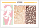 【骨・関節の病気】骨粗鬆症(こつそしょうしょう) ［シート］