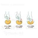 “The heart mechanism.” to feel stress