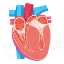 Hypertrophic cardiomyopathy　